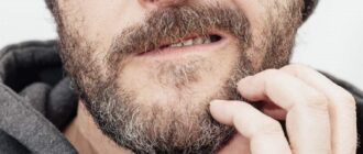How to keep beard from itching: 6 helpful tips & best guide